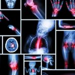 20 Sources of Pain In The Body That are DIRECTLY Linked to Each Specific Emotional States!