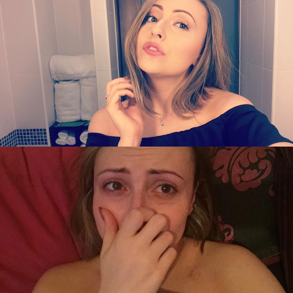 woman-before-and-after-photos-panic-attacks