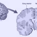 Harvard-MRI-Study-Shows-That-Meditation-Literally-Rebuilds-Your-Brain’s-Gray-Matter-In-8-Weeks