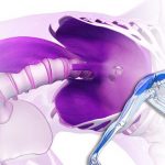 The ‘Muscle Of The Soul’ May Be Causing You Fear And Anxiety!