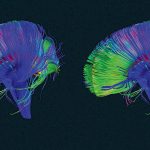 How To Use The DELETE Button?