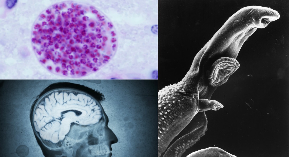 scientists-claim-mind-control-bug-affects-population