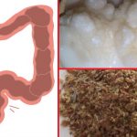 You might have 33 POUNDS OF TOXINS in your intestines. This is how to GET RID of them