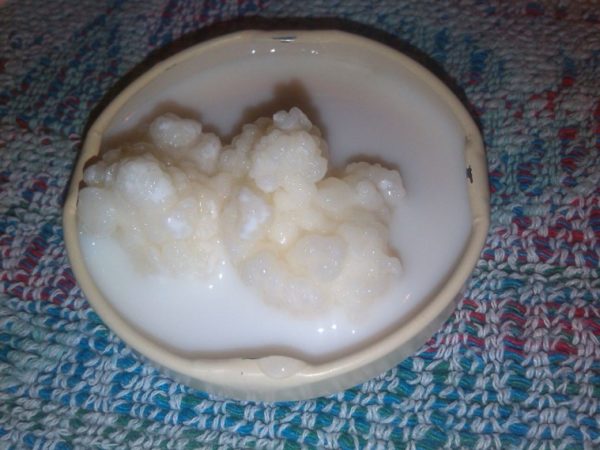 You might have 33 POUNDS OF TOXINS in your intestines. This is how to GET RID of them - Kefir