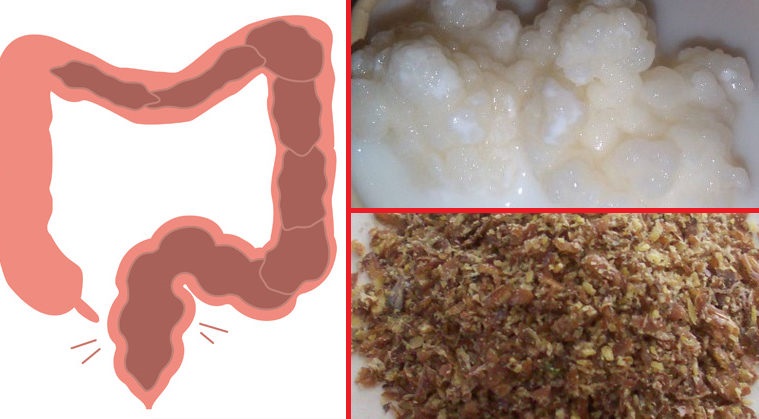 how-to-get-rid-of-toxins-in-your-intestines