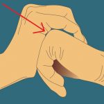 A Man Cracked The Knuckles On His Left Hand Every Single Day For 60 Years. THIS Is The Result…