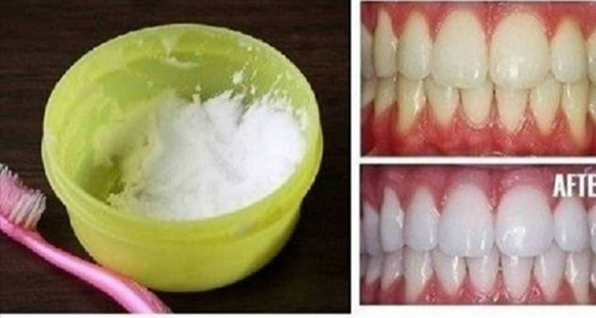 how-to-make-your-teeth-white