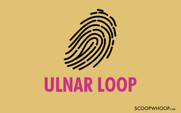 Ulnar Loop