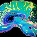 your-brain-has-anti-memories