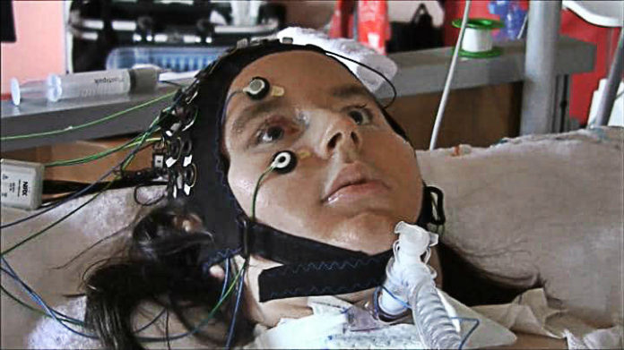 Paralized Patients Tell Doctors They Are Happy