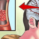 32 Signs You Immediately Need More Magnesium (and how to get it)