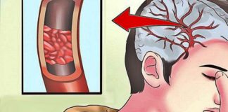 32 Signs You Need More Magnesium