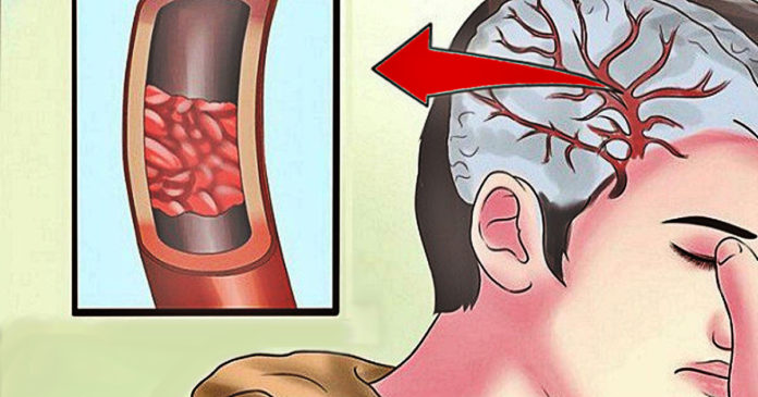 32 Signs You Immediately Need More Magnesium (and how to get it) 32 Signs You Need More Magnesium