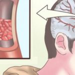 32 Signs You Immediately Need More Magnesium (and how to get it)