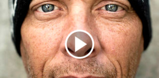 Guy Hit His Head Musical GENIUS