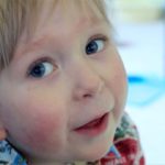 The Boy Who Was Born With Almost No Brain 1