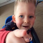 The Boy Who Was Born With Almost No Brain 2