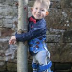 The-Boy-Who-Was-Born-With-Almost-No-Brain-5