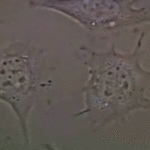 plant makes cancer cells disintegrate within 48 hours