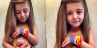 Girl Born With Heart Outside
