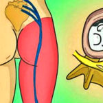 How to Release the Pinched Nerve in the Lumbar Area