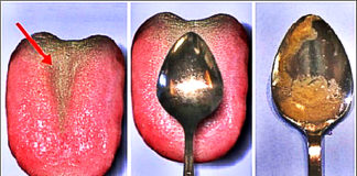 THIS Is How To Check Your Health In Under A Minute With Only A Spoon… How To Check Your Health With A Spoon
