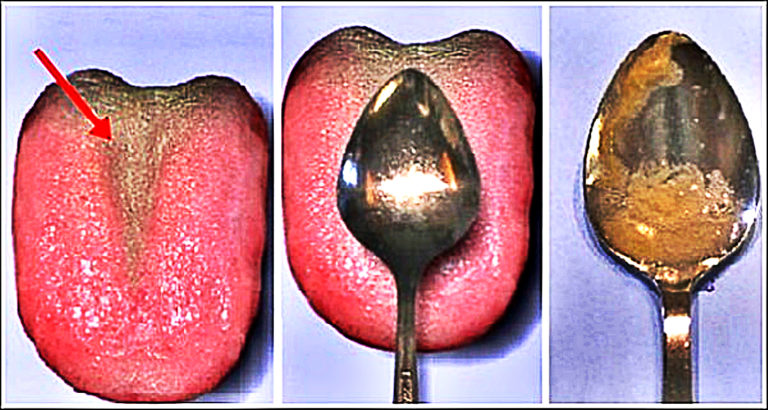 How To Check Your Health With A Spoon