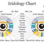 Eyes Changed Color After Eating Raw Vegan For 6 Years