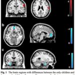 Being an Only Child Study
