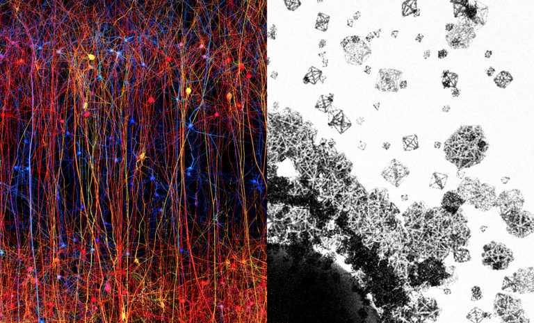 The Brain Operates In 11 Dimensions