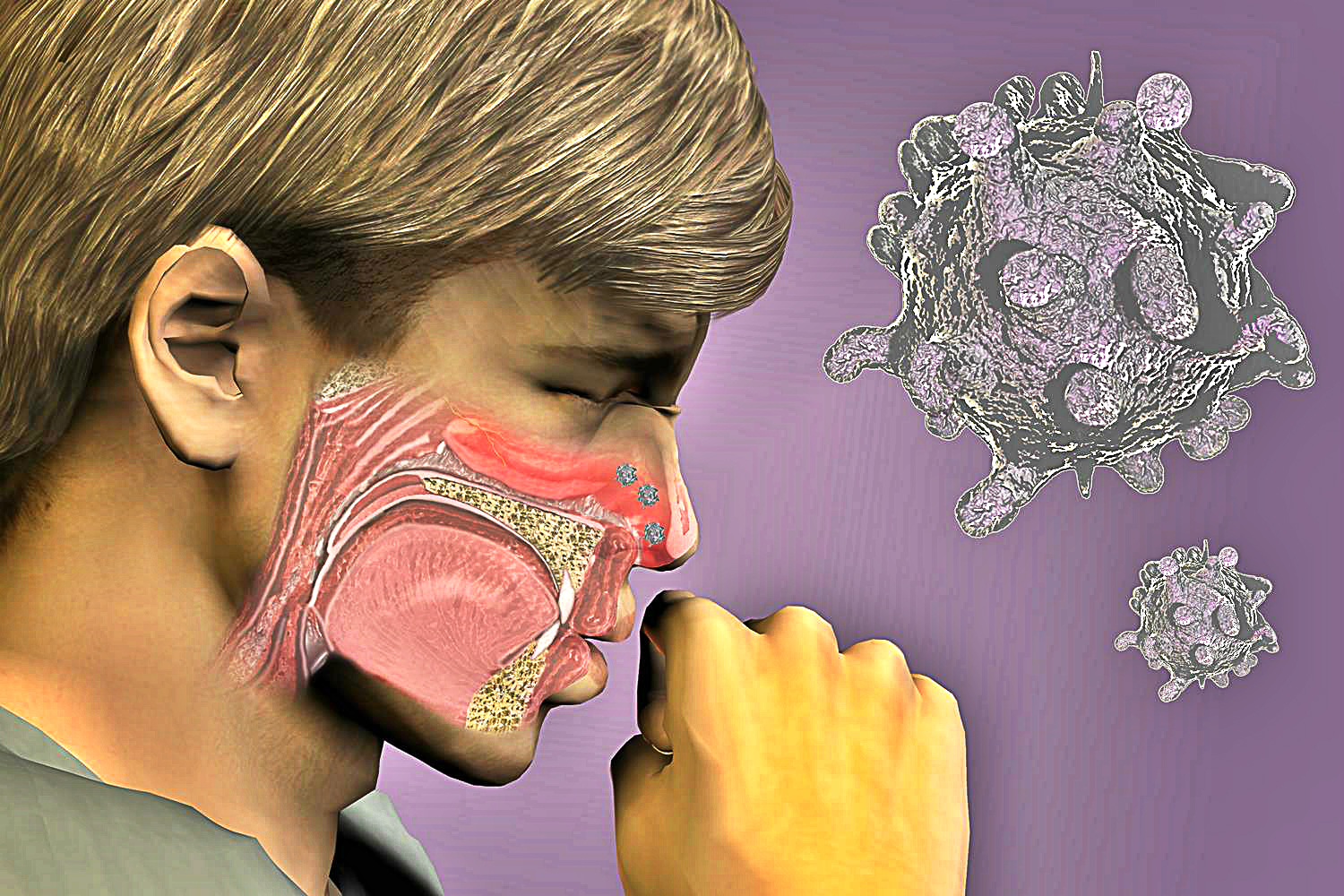 Вирус заложенность носа