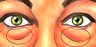 The Best Natural Treatments To Remove Dark Circles and Bags Under The Eyes Best Natural Treatments To Remove Dark Circles Under The Eyes