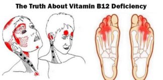 Truth About Vitamin B12 Deficiency