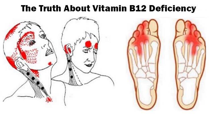 Truth About Vitamin B12 Deficiency