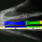 Humans The Golden Ratio And Fibonacci Sequence