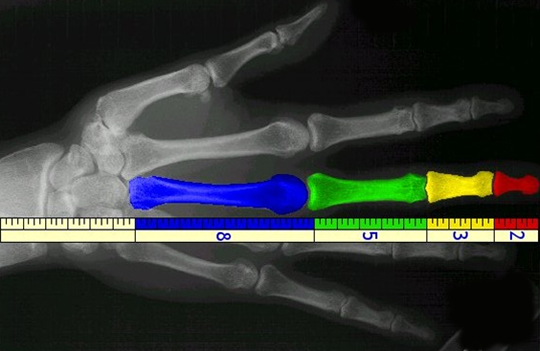 Humans The Golden Ratio And Fibonacci Sequence