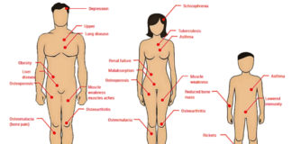 factors-that-cause-vitamin-d-deficiency