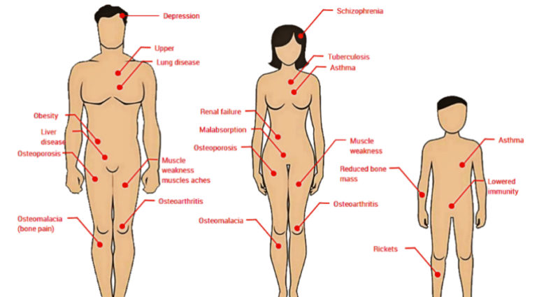 factors-that-cause-vitamin-d-deficiency