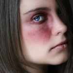 They hurt you physically.