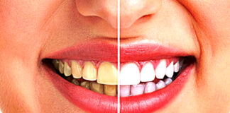 how-to-improve-your-smile-and-get-confidence