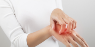 nutrition-guide-sensitive-skin