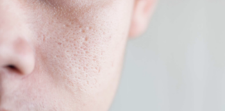 how-to-shrink-your-pores-naturally