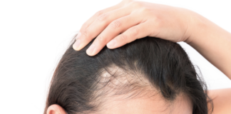 how-much-hair-restoration-cost-these-days