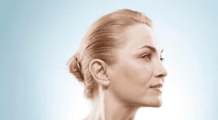 ponytail-facelift-recovery