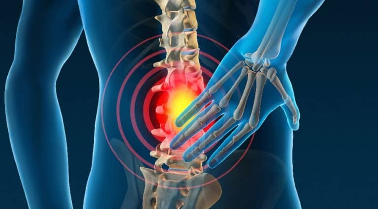 Herniated Discs: 5 Great Pain Management Tips