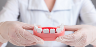 the-impact-of-diet-on-oral-health-a-preventative-dentistry-perspective