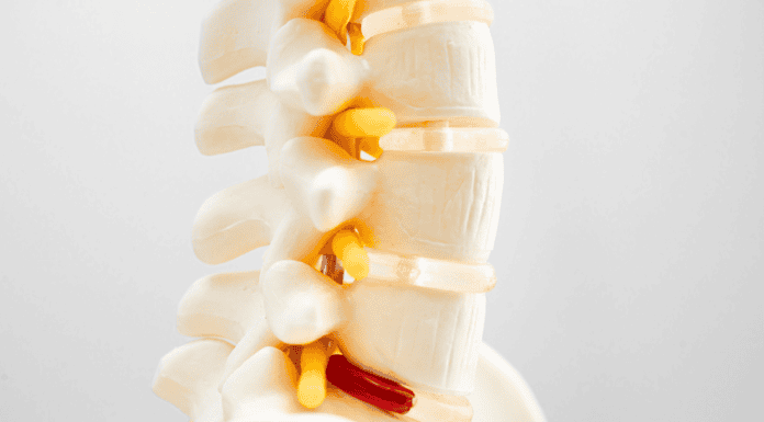 understanding-slipped-discs