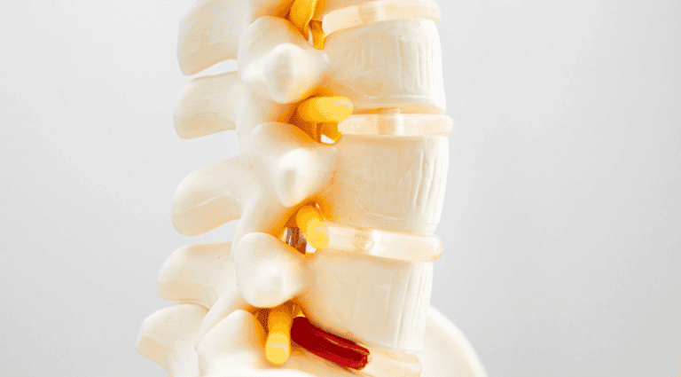 understanding-slipped-discs